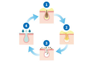 4 ステップ設計